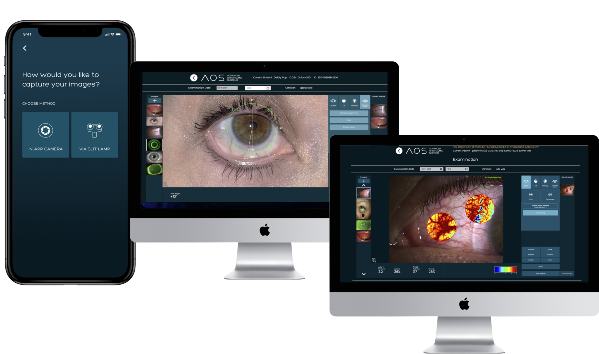 Image shows product developed on Camgenium's platform.  Photos of eyes are taken by the patient at home and transferred to the clinician who analyses them using automatic routines.